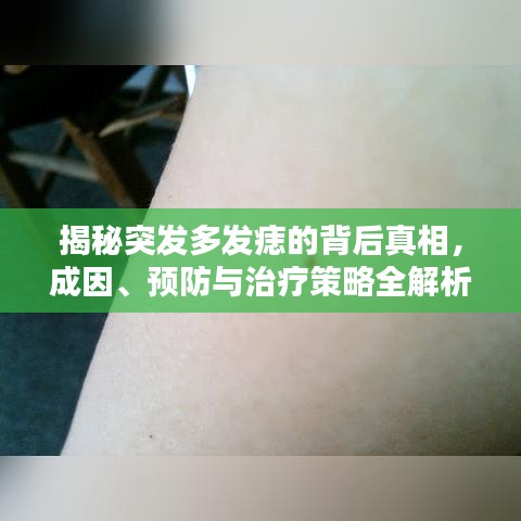 揭秘突发多发痣的背后真相，成因、预防与治疗策略全解析