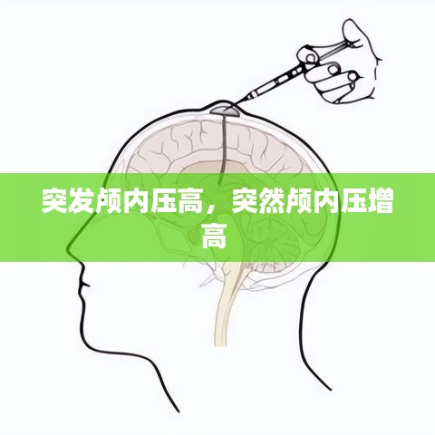 突发颅内压高，突然颅内压增高 