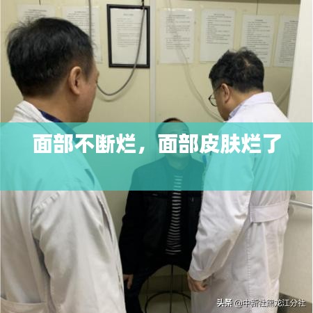 面部不断烂，面部皮肤烂了 