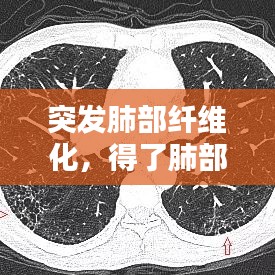突发肺部纤维化，得了肺部纤维化是不很严重? 